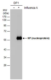 Anti-Influenza A virus Nucleoprotein antibody used in Western Blot (WB). GTX125989